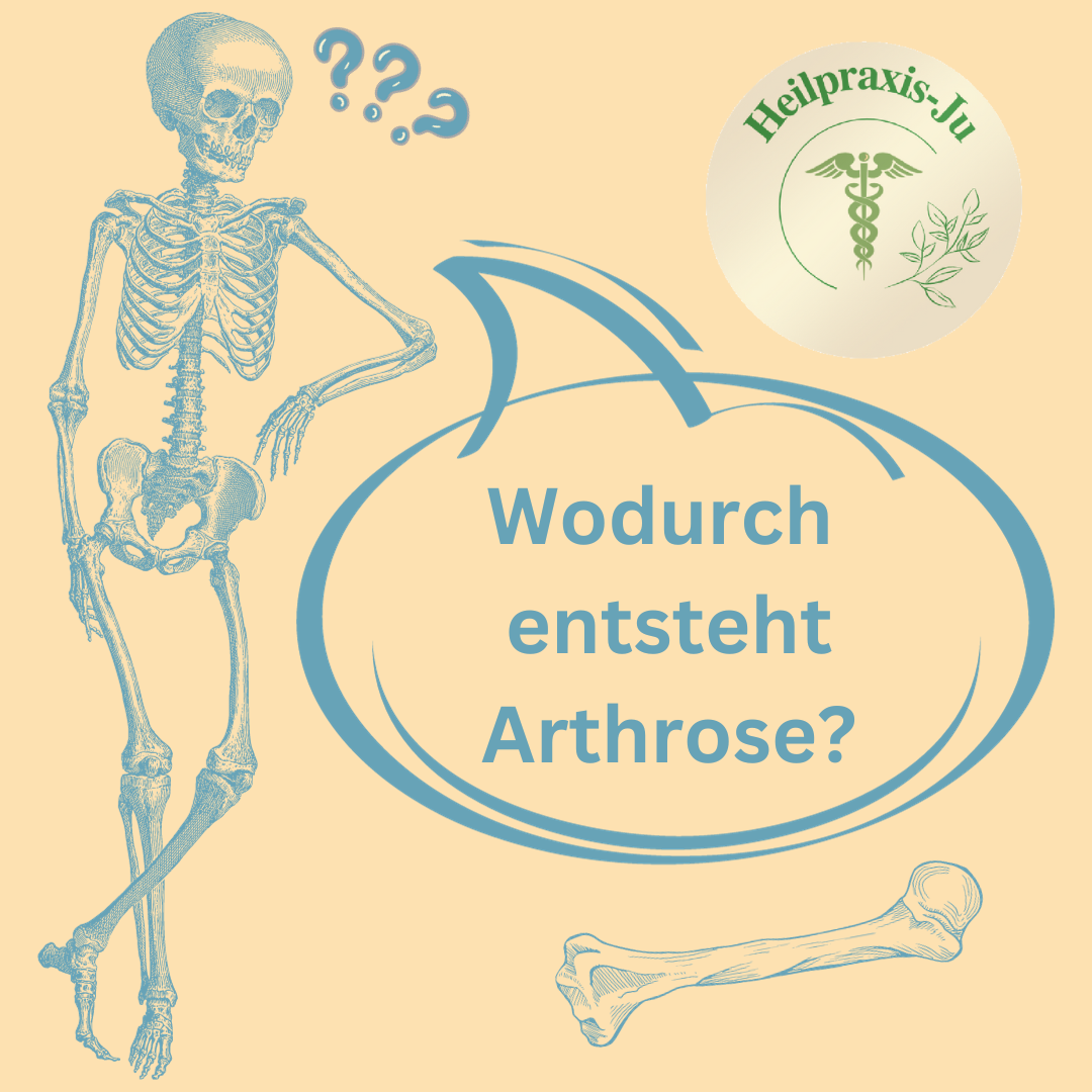 Arthrose - Entstehung